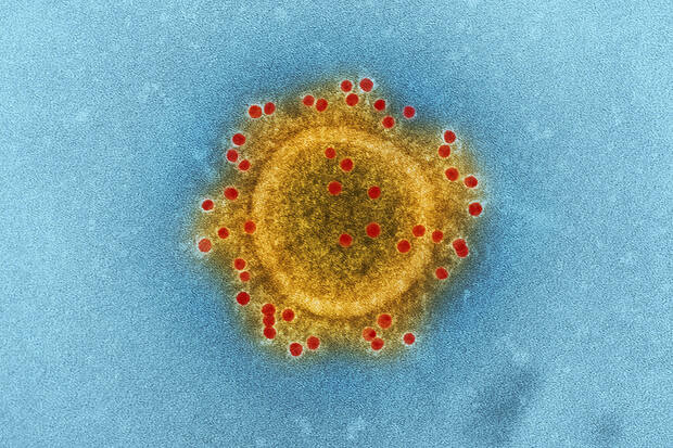 RS virus je v Česku na vzestupu