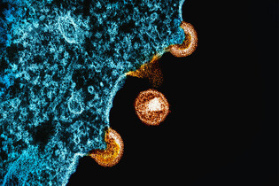 Australská laboratoř ztratila přehled o stovkách nebezpečných virů