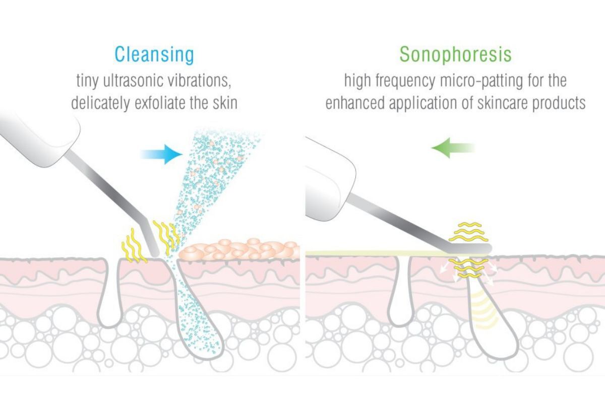 Rio Ultrasonic Facial